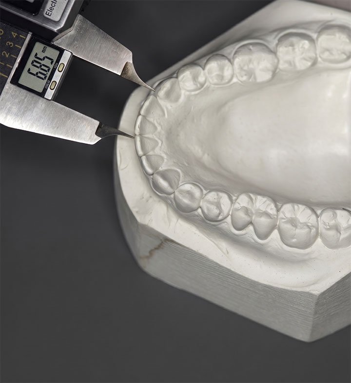 Digital caliper measuring a dental study model